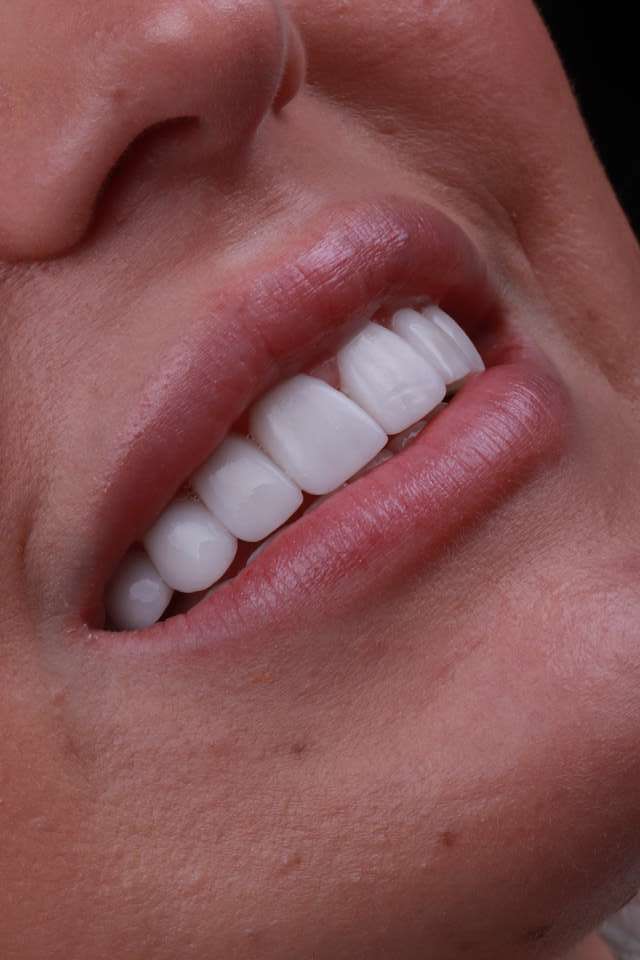 Cosmetic Dentistry, Franklin, TN